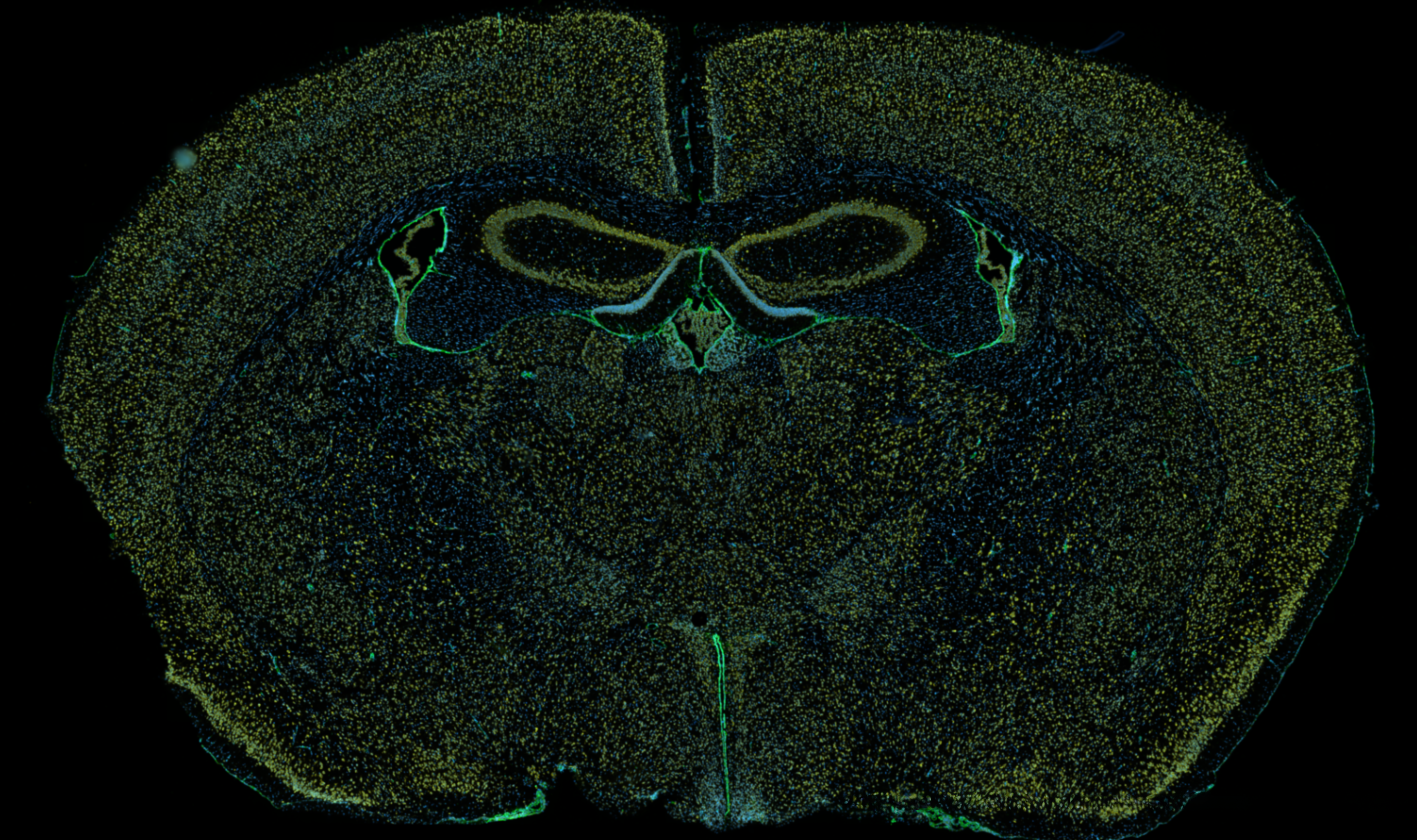 Nihal Salem, Mayfield Lab
